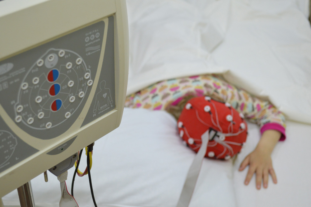 Відео ЕЕГ моніторинг цілодобово Відео ЕЕГ моніторинг цілодобово